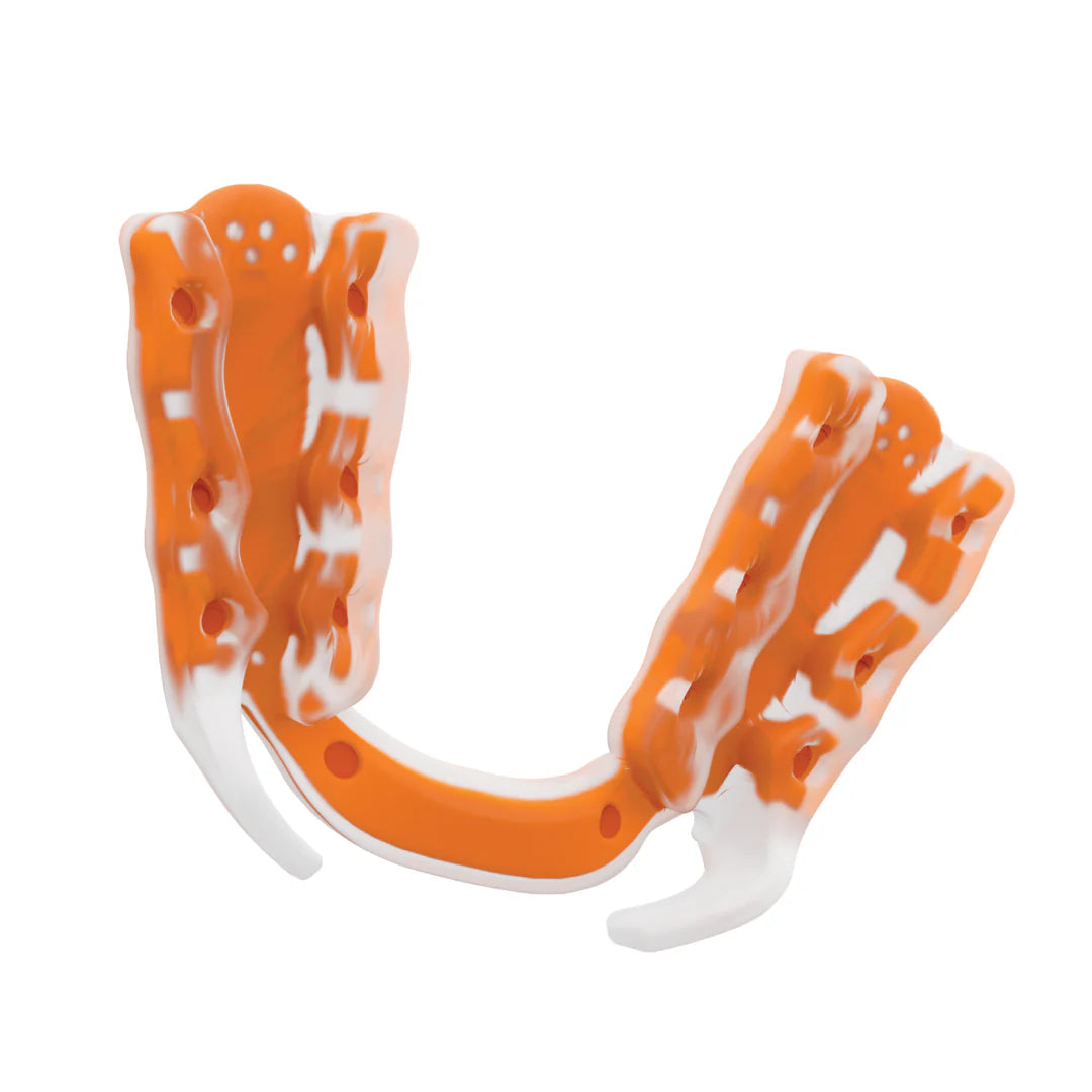 Bottom view of the Airwaav PX2. You can see how the material moulds to the teeth.