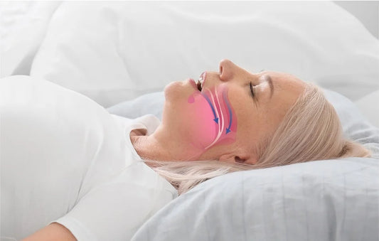 Image of a woman lying in bed breathing through her mouth. The nasal and mouth airways are highlighted.