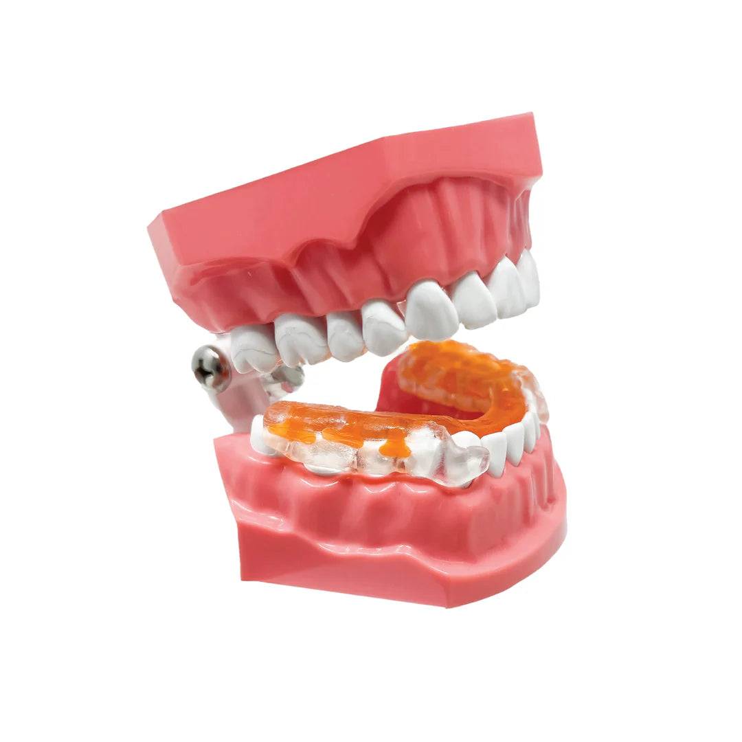 This is an image of the AIRWAAV in a set of take teeth. It demonstrates how the device fits on the bottom of the teeth. 