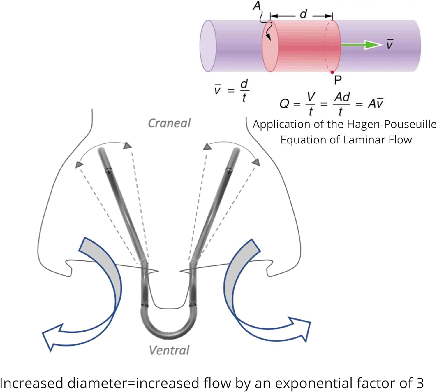 Diagram showing how nasal dilator expands the airways working with cartlidge in the body.